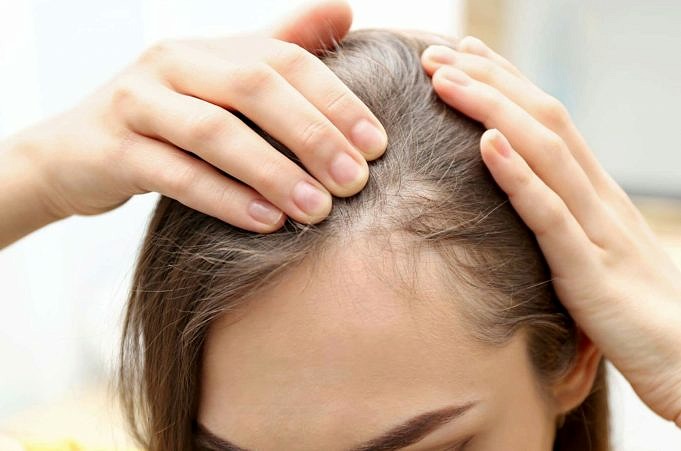 Friseure Teilen Ihre Top-Tipps Für Dünner Werdendes Haar